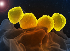 ABCs (Group A Streptococcus)