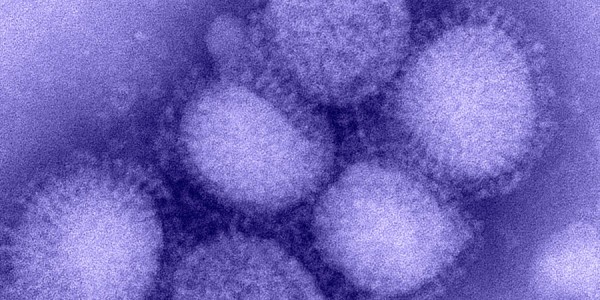 Influenza virus. Image courtesy http://cdc.gov.