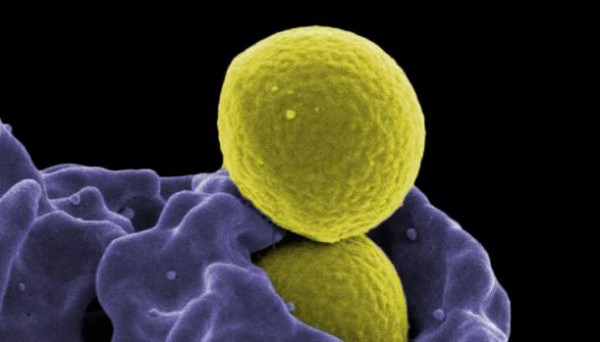 MRSA