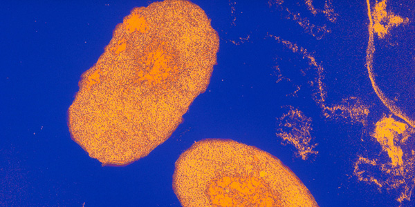 Pertussis bacteria (Bordetella pertussis)